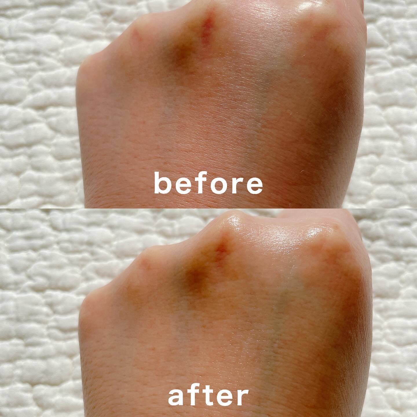 ツボクサ化粧水/ONE THING/化粧水を使ったクチコミ（3枚目）