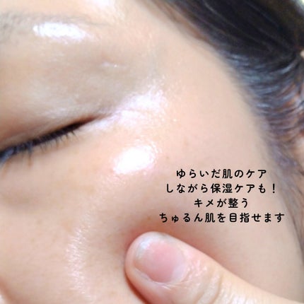 AZLAIN クリーム AZコンセントトレートクリーム/AZELAIN/フェイスクリームを使ったクチコミ(7枚目)