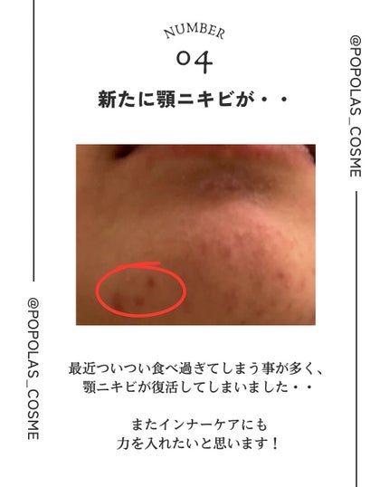 肌をうるおす保湿クリーム/肌をうるおす保湿スキンケア/フェイスクリームを使ったクチコミ(5枚目)