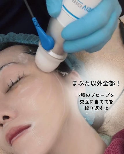 marc♡美容垢フォロバ on LIPS 「♡メソナJ通常塗布の300倍!エレクトロポーションの70倍と言..」(4枚目)