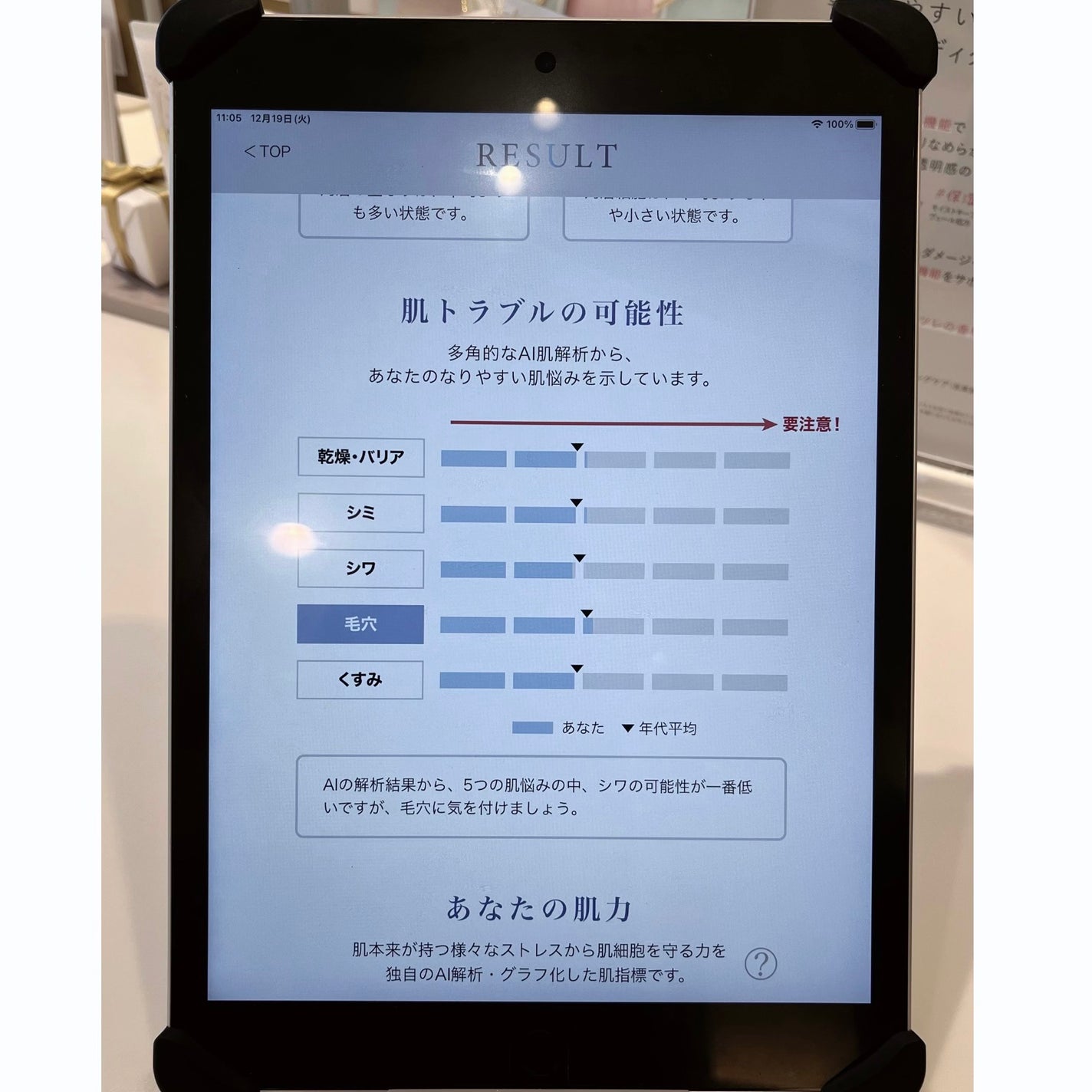 KAORIN on LIPS 「角質で肌解析─・・─・・─・・─・・─・・─・・─・・─・・─..」(6枚目)