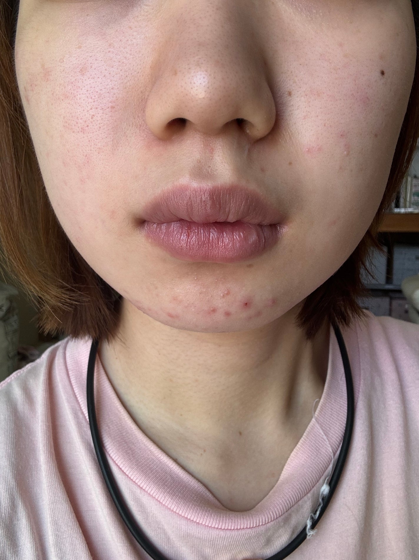 薬用しみ集中対策 プレミアム美容液/メラノCC/美容液を使ったクチコミ(2枚目)