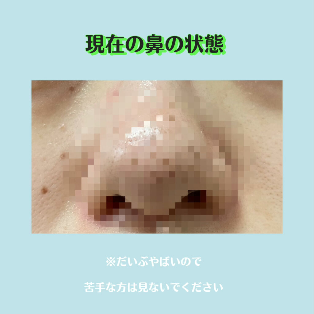 スキンコンディショナー/CEZANNE/化粧水を使ったクチコミ（1枚目）