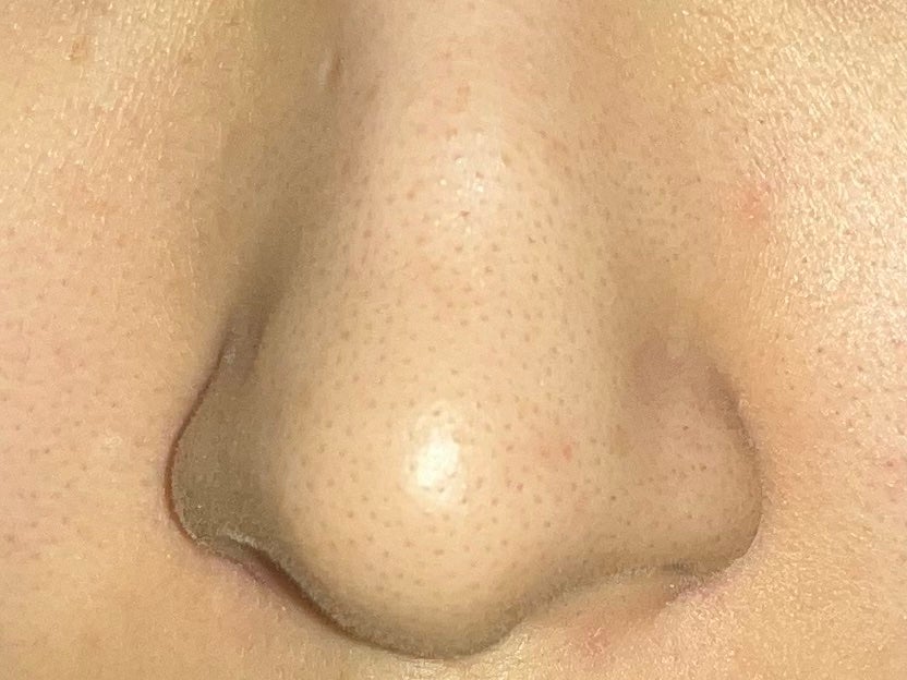 ノーモアブラックヘッド(ノーズピーリング)/One-day's you/スクラブ・ゴマージュを使ったクチコミ(5枚目)