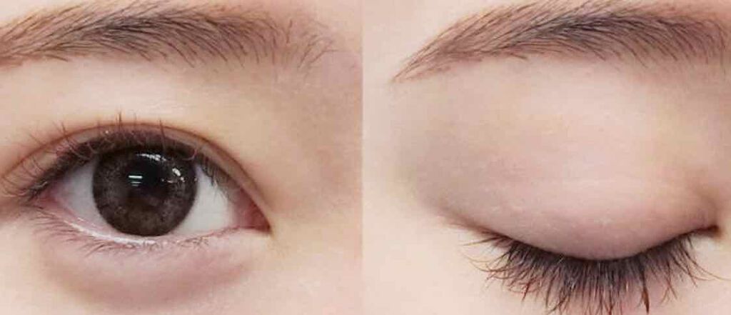 のび〜る アイテープ 両面テープタイプ/DAISO/二重まぶた用アイテムを使ったクチコミ(1枚目)