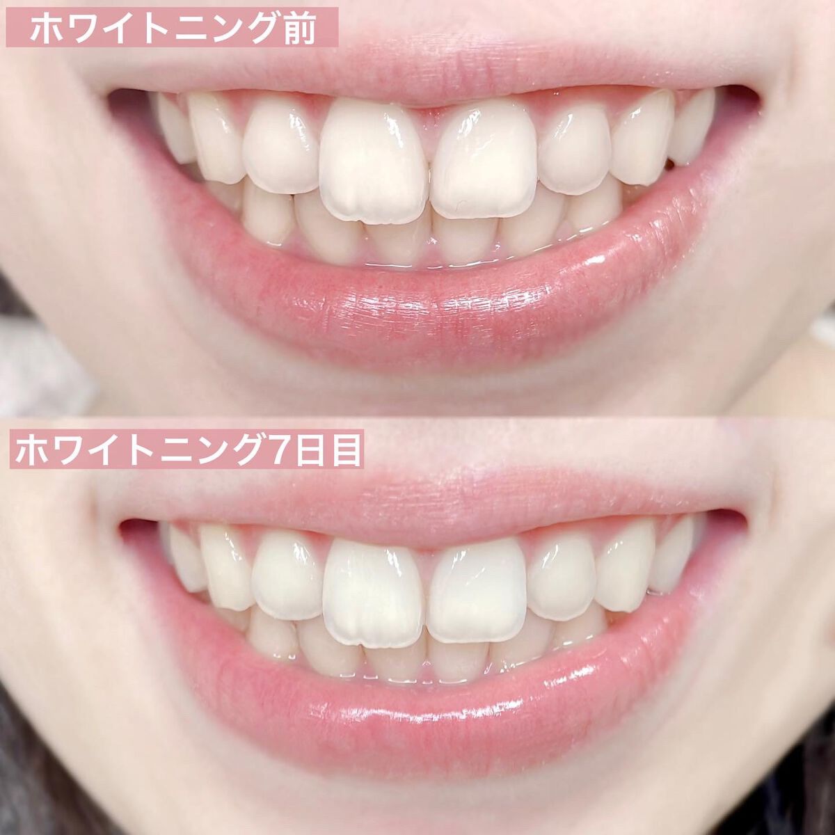 ホワイトニング/TeethLab/歯磨き粉を使ったクチコミ(7枚目)