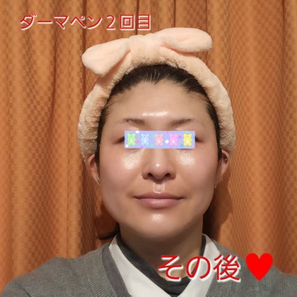 ステムセルフセラム/KISO/美容液を使ったクチコミ(1枚目)