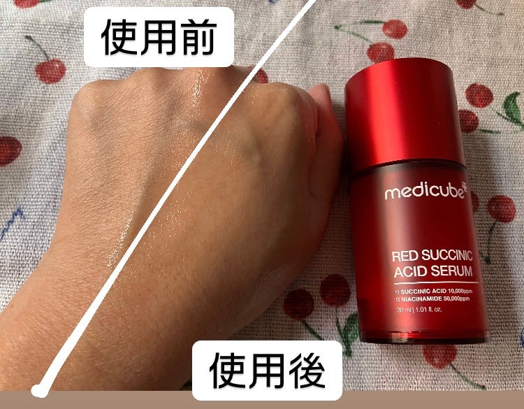 レッドアクネセラム/MEDICUBE/美容液を使ったクチコミ(4枚目)