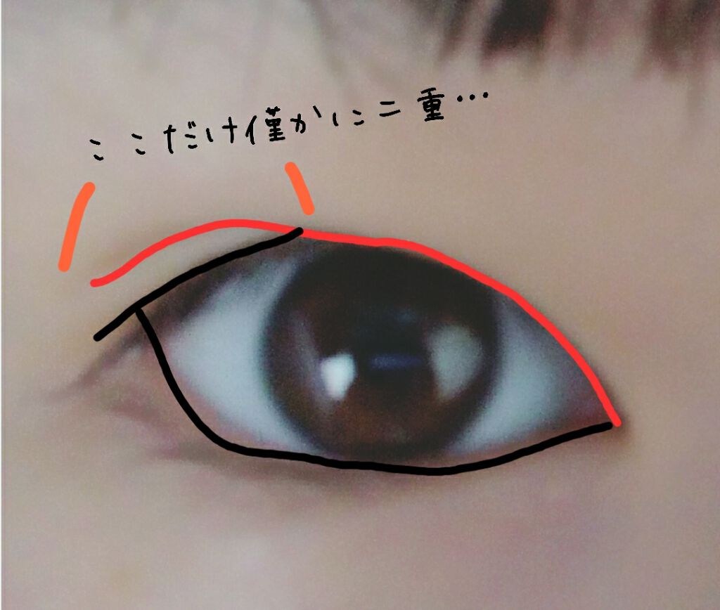 二重の作り方/その他を使ったクチコミ（3枚目）