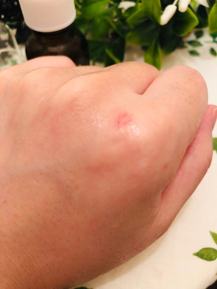 プラツェンタール エキストレ/スノーヴァ/美容液を使ったクチコミ(5枚目)