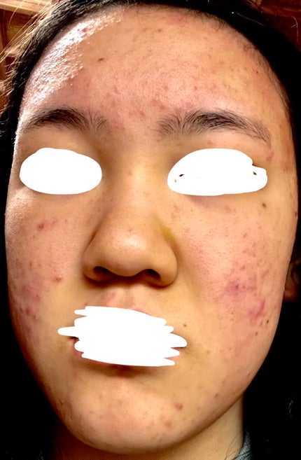 を使ったクチコミ(3枚目)