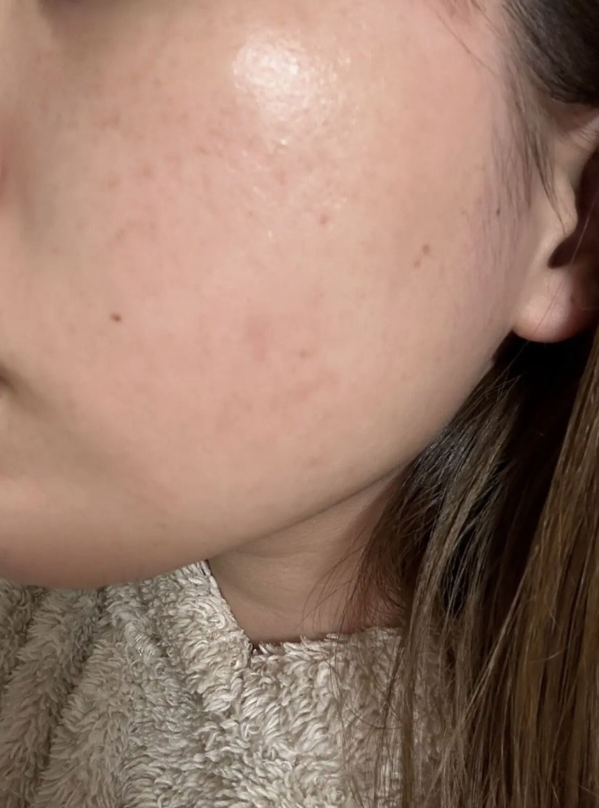 ホワイトニング ミスト セラム/アルージェ/ミスト状化粧水を使ったクチコミ（3枚目）