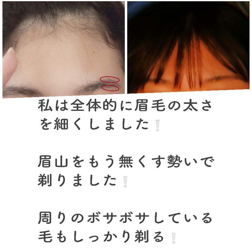 プレミア敏感肌用 Lディスポ/シック/シェーバーを使ったクチコミ（2枚目）