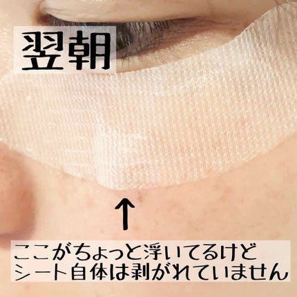 プロテオフィルパッチ/METLLASSE(メトラッセ)/シートマスク・パックを使ったクチコミ(6枚目)