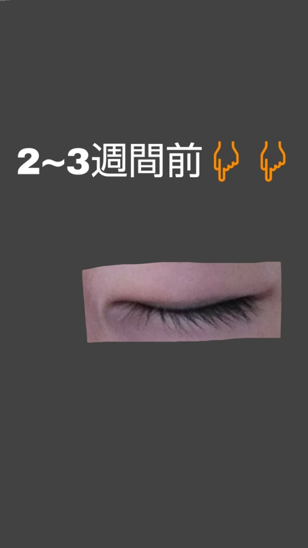 ニベアクリーム/ニベア/ボディクリームを使ったクチコミ（2枚目）