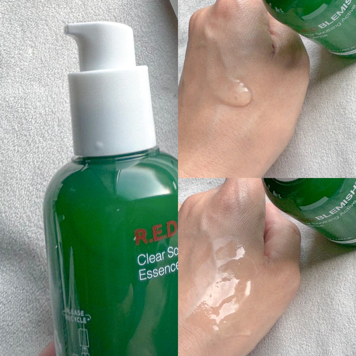 レッドブレミッシュ クリアスージングクリーム/Dr.G/フェイスクリームを使ったクチコミ(4枚目)