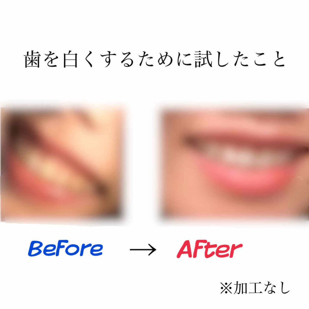 プレミアム ステインクリア ペースト/オーラツー/歯磨き粉を使ったクチコミ（1枚目）