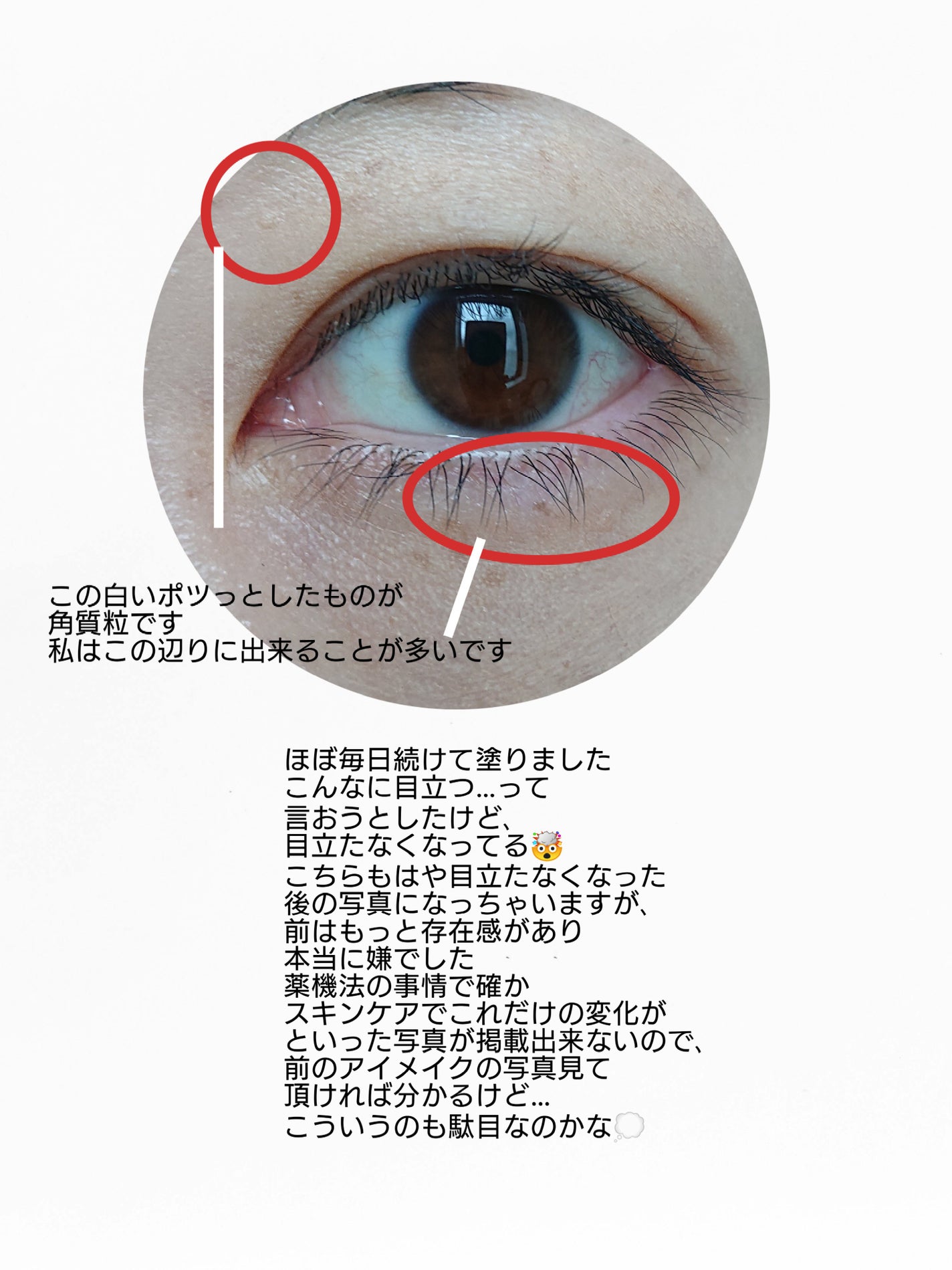 ポロリンボE X/コスメテックスローランド/レッグ・フットケアを使ったクチコミ(6枚目)