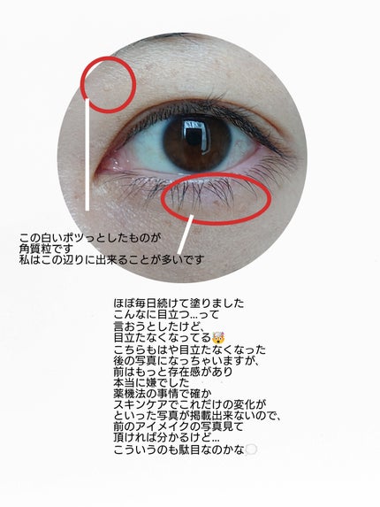 ポロリンボE X/コスメテックスローランド/レッグ・フットケアを使ったクチコミ(6枚目)