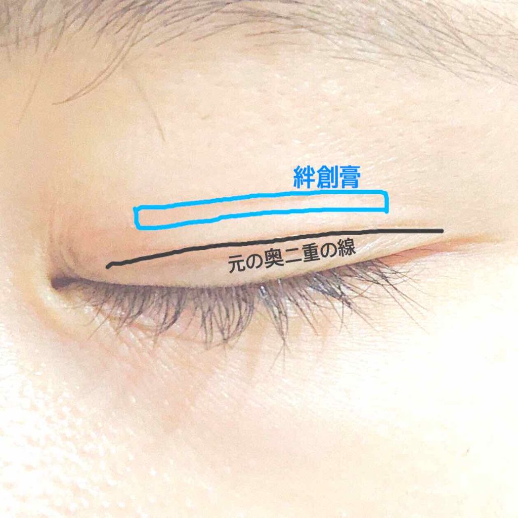 絆創膏/DAISO/その他を使ったクチコミ(2枚目)