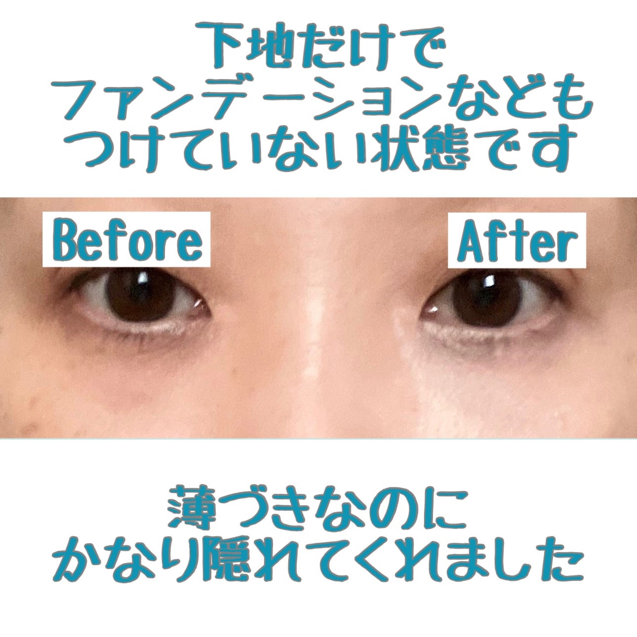 アイレノール クマクリーム/IRENOL/アイケア・アイクリームを使ったクチコミ(7枚目)