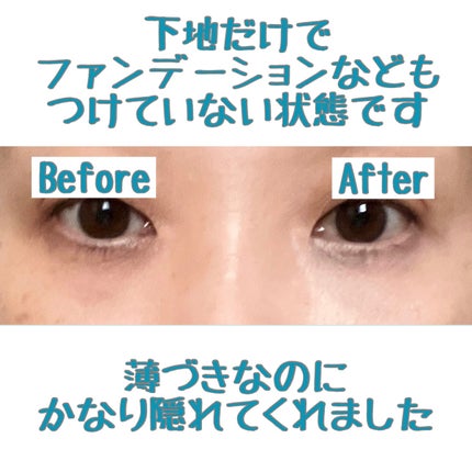 アイレノール クマクリーム/IRENOL/アイケア・アイクリームを使ったクチコミ(7枚目)