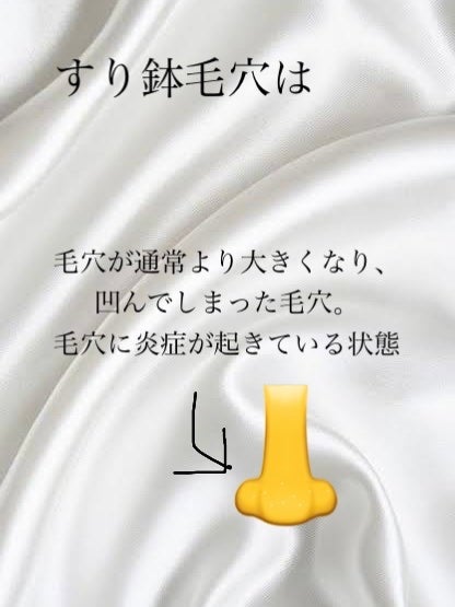 ハトムギ化粧水(ナチュリエ スキンコンディショナー R )/ナチュリエ/化粧水を使ったクチコミ(4枚目)