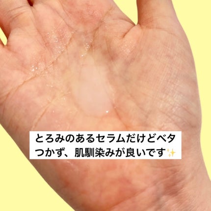 ririðçŸå®¹ããŒã¹ðãã©ãã100 on LIPS ãnumbuz:nð5çªçœçã°ã«ã¿ããªã³CçŸå®¹æ¶²ãããããããã..ãïŒ3æç®ïŒ