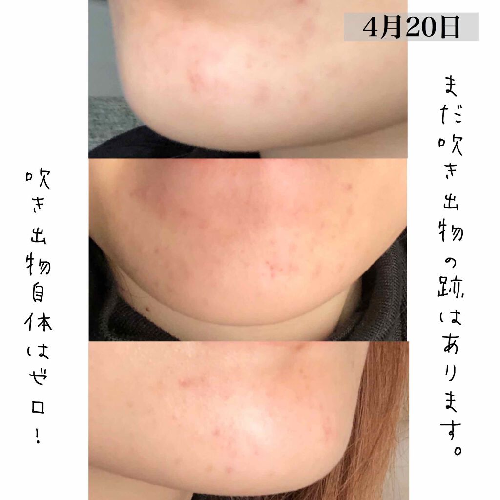 ディアナチュラスタイル ヘム鉄×葉酸+ビタミンB6・B12・C/Dear-Natura (ディアナチュラ)/食品を使ったクチコミ(4枚目)