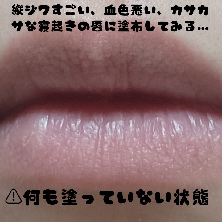 リードルS リッププランパーエキスパート/VT/リッププランパーを使ったクチコミ（3枚目）