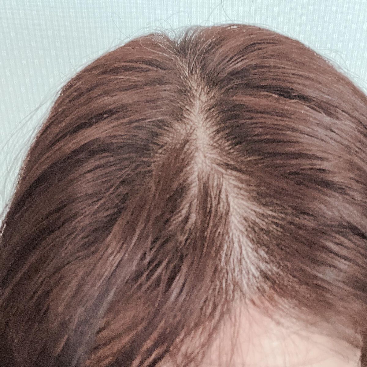 薬用育毛剤フエルダン/リムサプライ/頭皮ローションを使ったクチコミ（3枚目）