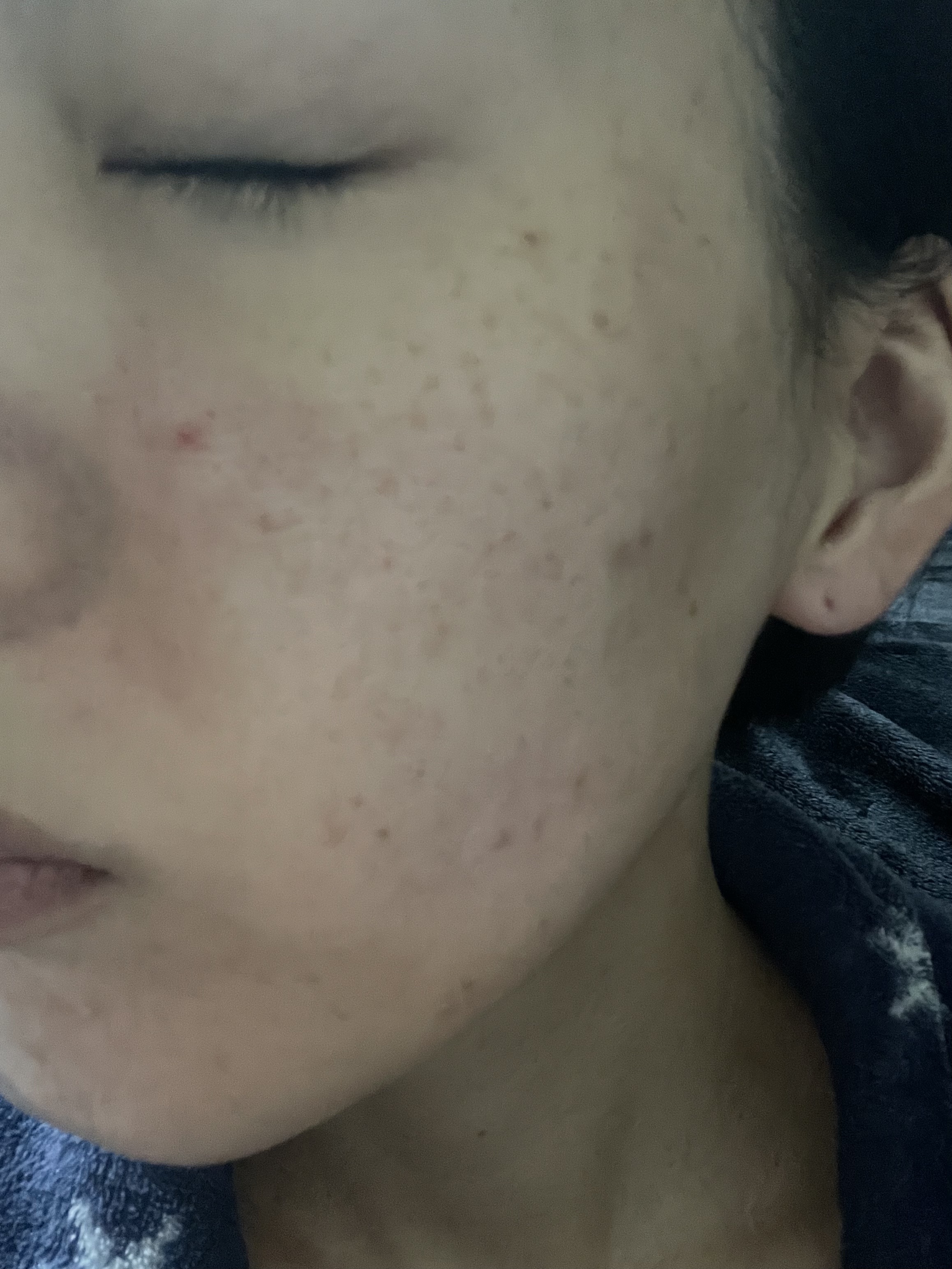 ツボクサ化粧水/ONE THING/化粧水を使ったクチコミ（2枚目）