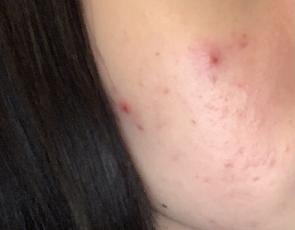 極潤ヒアルロン乳液/肌ラボ/乳液を使ったクチコミ（2枚目）