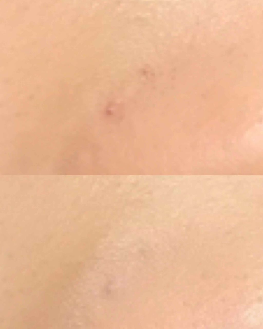 ポアカバーベース＜部分用化粧下地＞/ettusais/化粧下地を使ったクチコミ（2枚目）