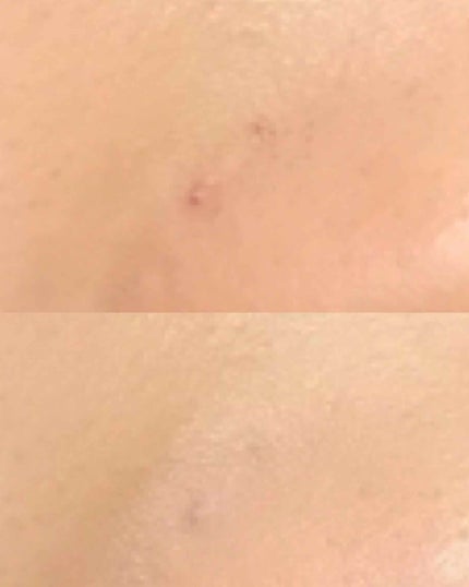 ポアカバーベース<部分用化粧下地>/ettusais/化粧下地を使ったクチコミ(2枚目)