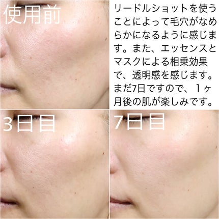 リードルショット100/VT/美容液を使ったクチコミ(5枚目)