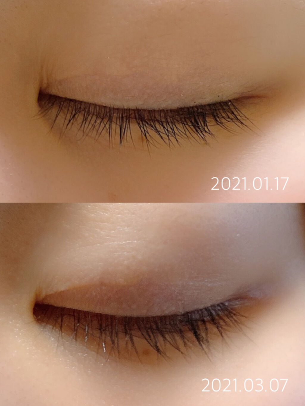 スカルプD ボーテ ピュアフリーアイラッシュセラム　プレミアム/アンファー(スカルプD)/まつげ美容液を使ったクチコミ（1枚目）