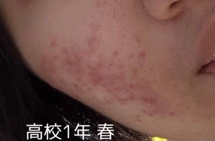 マイルド&モイスチャーアロエジェル/ネイチャーリパブリック/ボディローションを使ったクチコミ(1枚目)