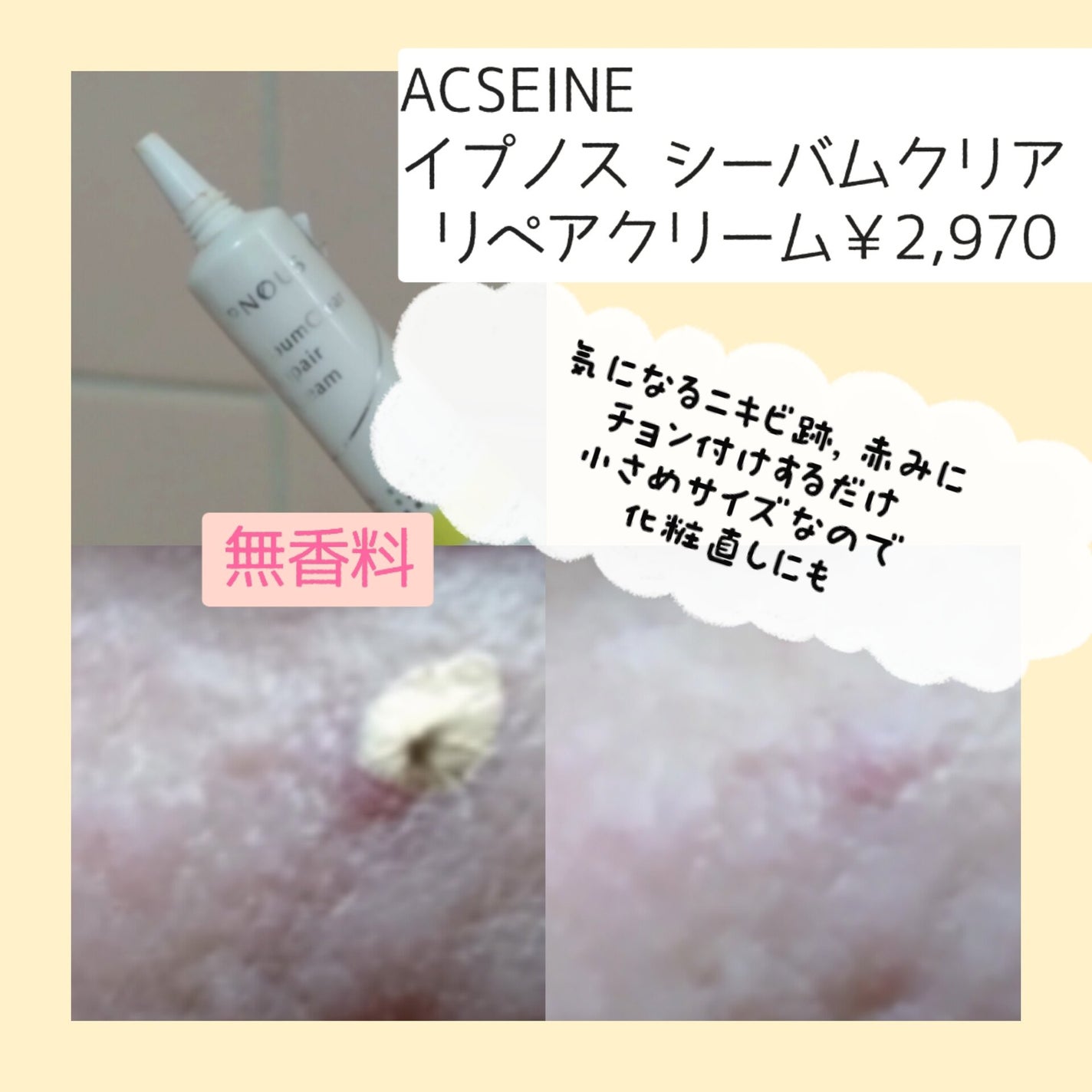 ã€ããã¹ ã·ãŒãã ã¯ãªã¢ ãªãã¢ã¯ãªãŒã /ACSEINE/ãã§ã€ã¹ã¯ãªãŒã ã䜿ã£ãã¯ãã³ãïŒ2æç®ïŒ