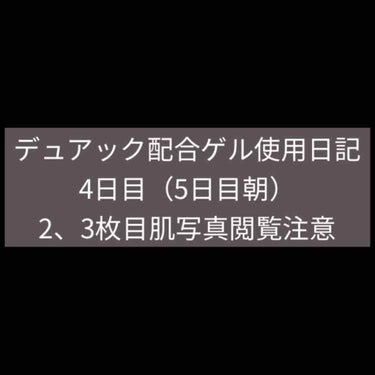 フワフワネコチャン on LIPS 「⚠︎知りたいことがあるので、宜しかったらコメントお願いします（..」（1枚目）