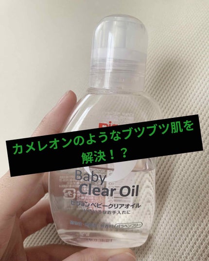 ベビーオイルR/ピジョン/ボディオイルを使ったクチコミ(1枚目)