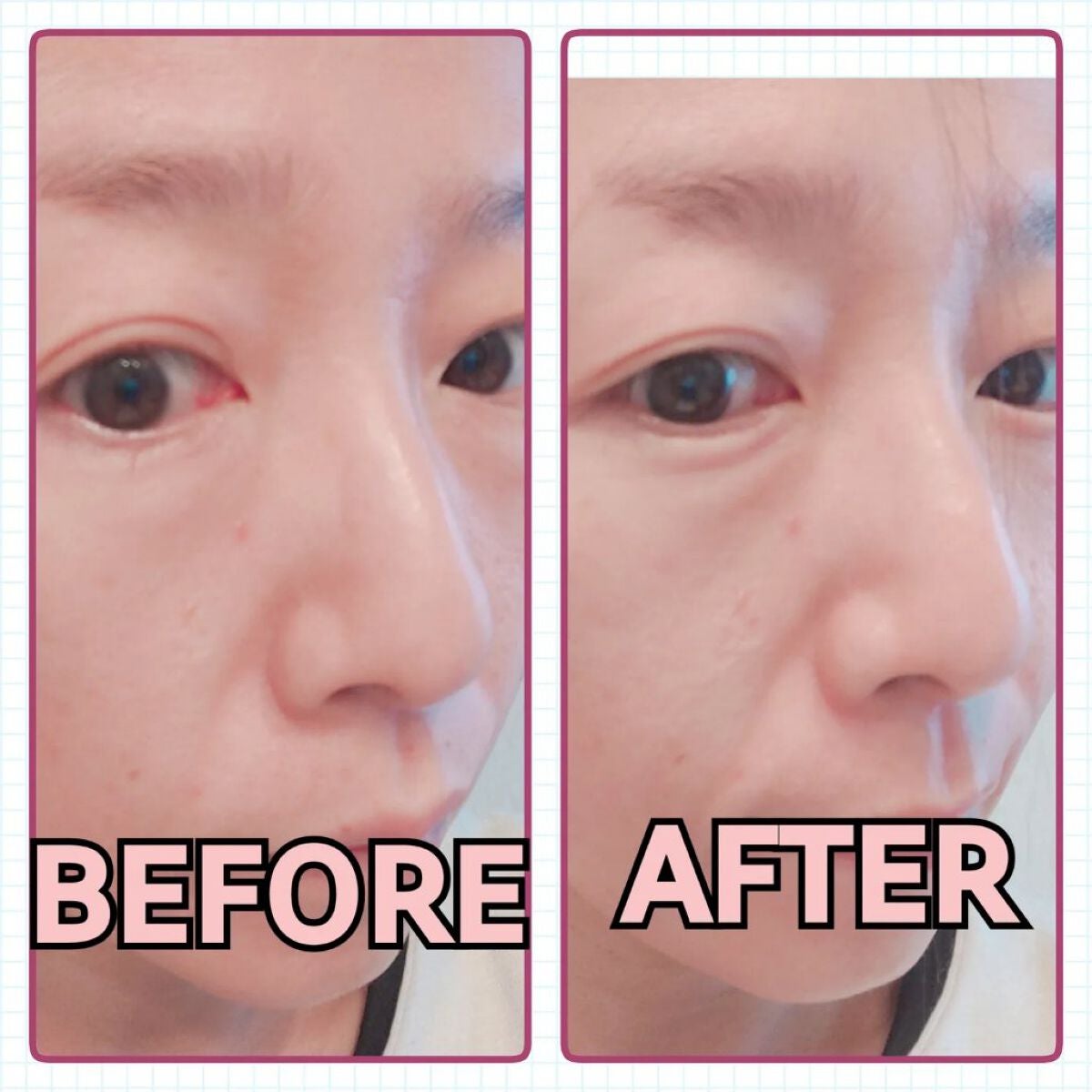 ブラックジェルクレンジング/.akaran/クレンジングジェルを使ったクチコミ(2枚目)