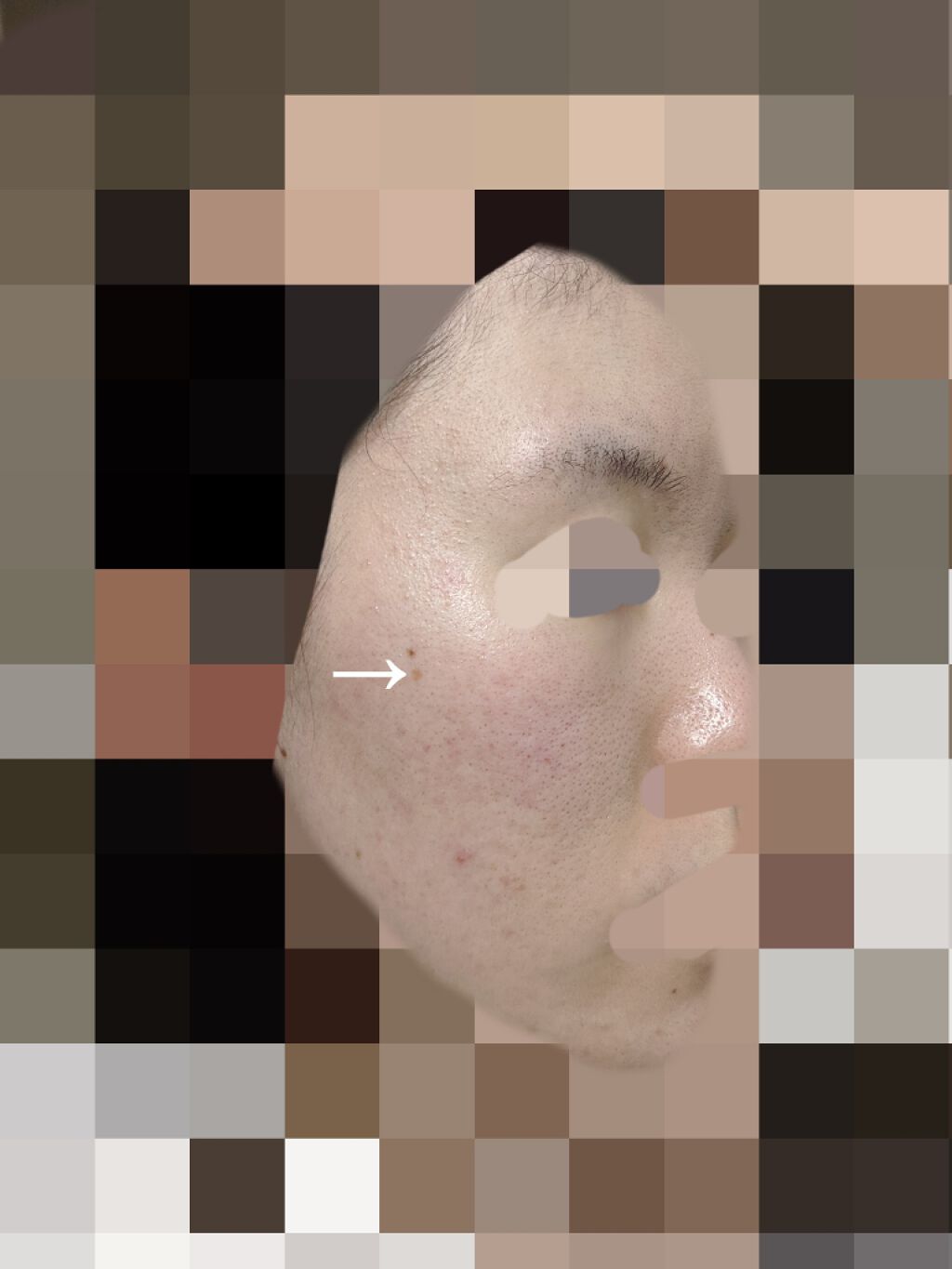 エバレッシュホワイトEXⅡ(医薬品)/matsukiyo/その他を使ったクチコミ（2枚目）