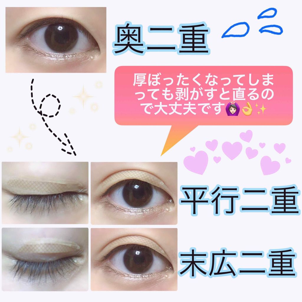 ふたえテープ 目立たず肌になじむ絆創膏タイプ/DAISO/二重まぶた用アイテムを使ったクチコミ（2枚目）