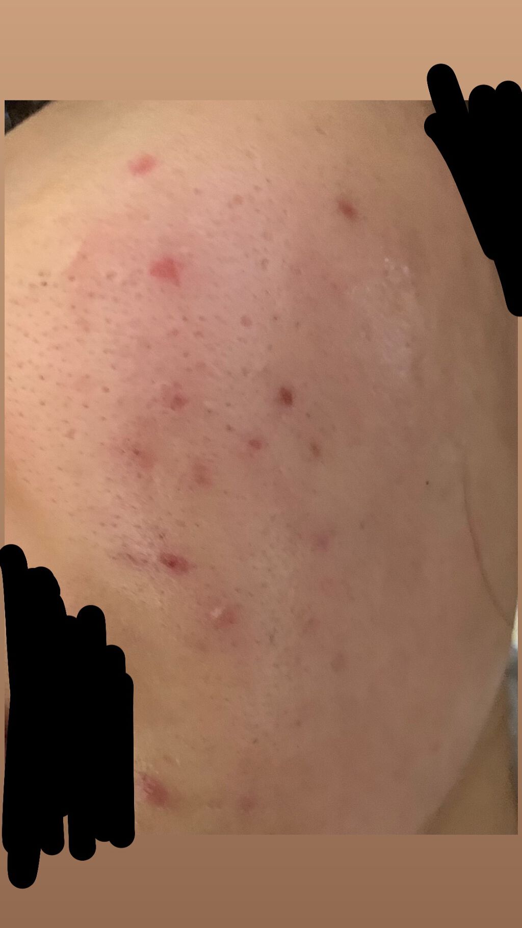 Tð on LIPS ãâŒïžãèŠèŠããåçãåºãŸãã®ã§ã泚æãã ããðââïžäžåŠçãã..ãïŒ3æç®ïŒ