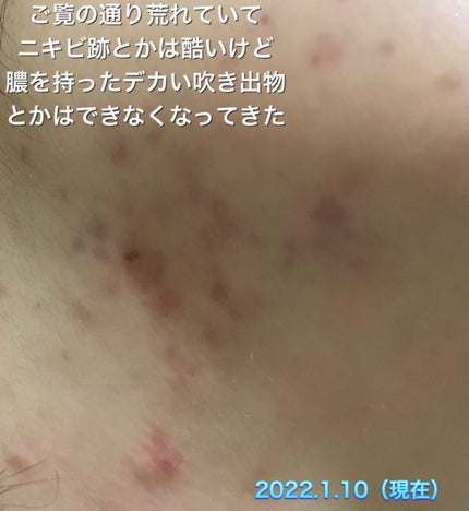 ザ・タイムR アクア/IPSA/化粧水を使ったクチコミ(4枚目)