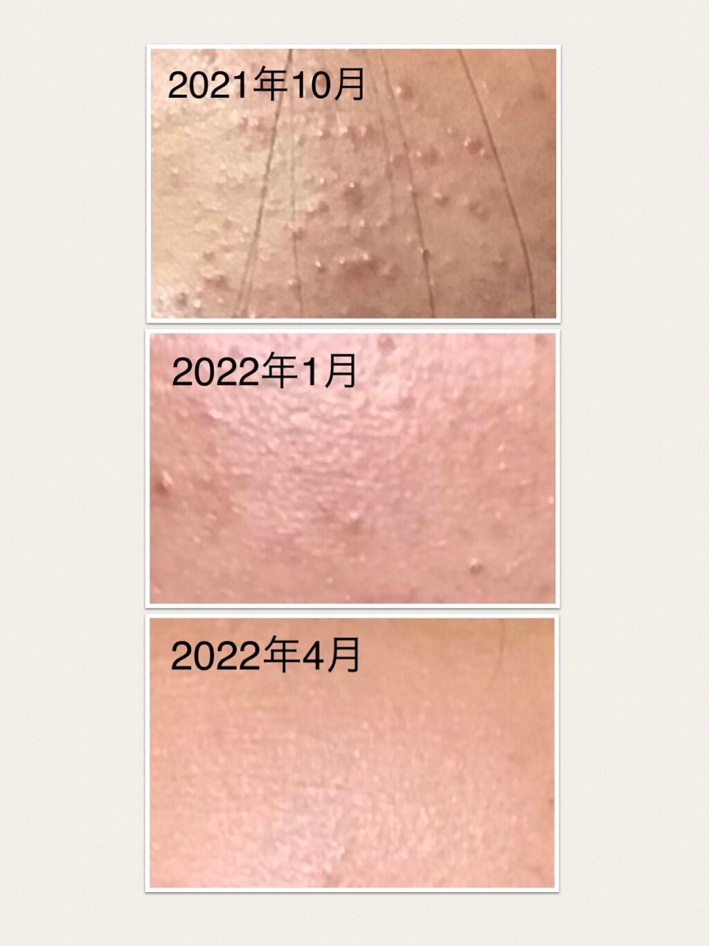 DHC ビタミンCハードカプセル/DHC/美容サプリメントを使ったクチコミ(2枚目)