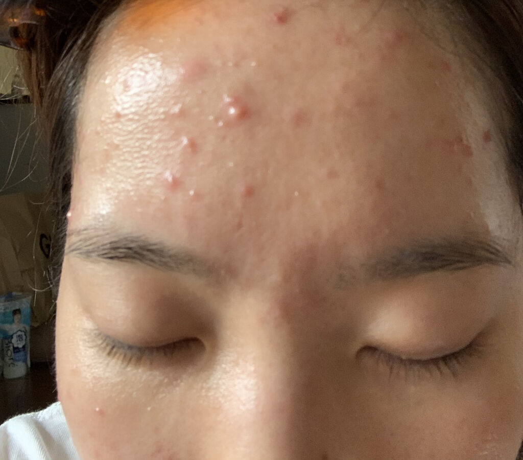 潤浸保湿 乳液/キュレル/乳液を使ったクチコミ（2枚目）