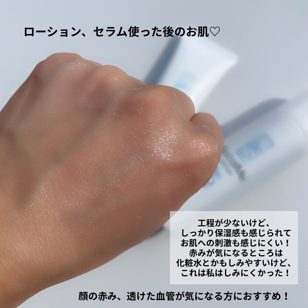 アカルミー化粧水/ワイズ/化粧水を使ったクチコミ(4枚目)