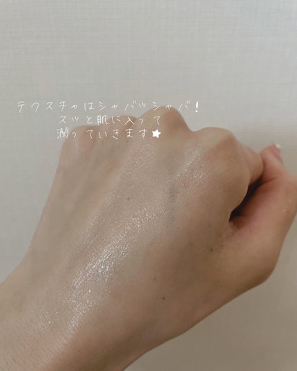 モイストケア ローション MB/d プログラム/化粧水を使ったクチコミ(4枚目)